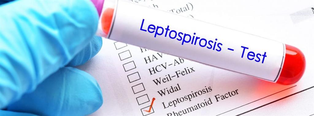 preocupan-gripe-y-leptospirosis-en-damnificado-estado-brasileno