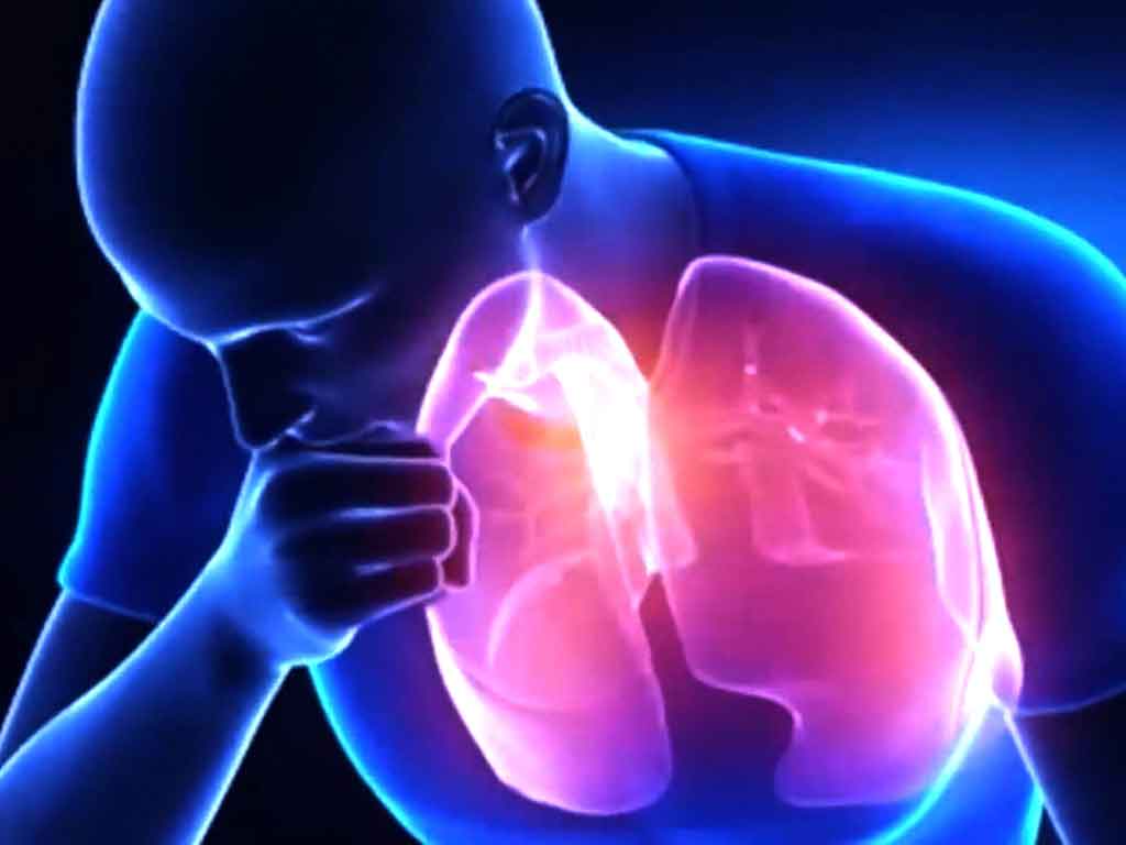 india-redefine-estrategia-contra-la-tuberculosis