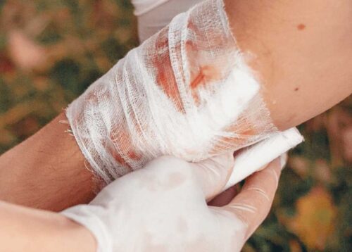 heridas-en-humanos-curan-mas-lento-que-en-otros-mamiferos