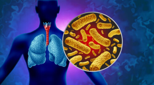 salud-reporta-repunte-de-casos-de-tosferina-en-guatemala