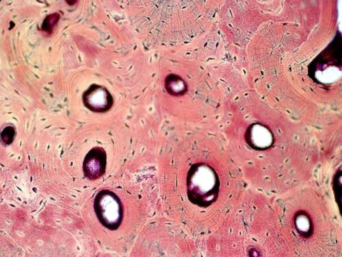 cientificos-rusos-crean-aplicacion-para-diagnostico-osteocondrosis