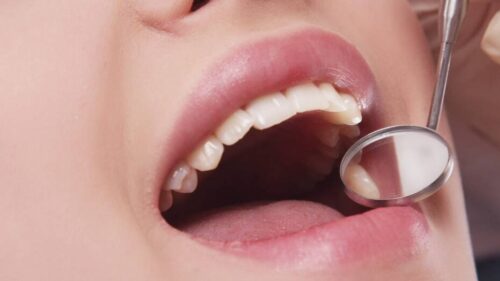 rusia-desarrollan-metodo-de-deteccion-temprana-del-cancer-bucal