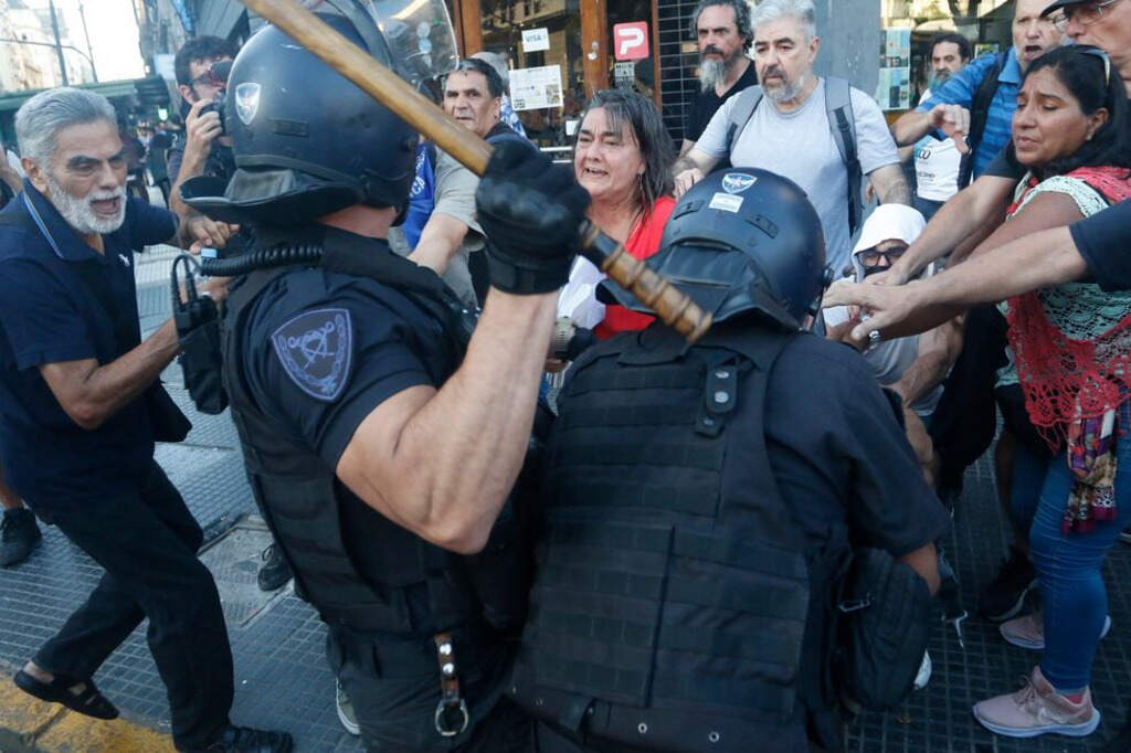 fotorreportera-argentina-agredida-en-represion-sigue-hospitalizada