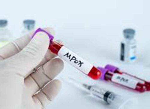 sube-a-tres-el-numero-de-muertos-por-mpox-en-angola